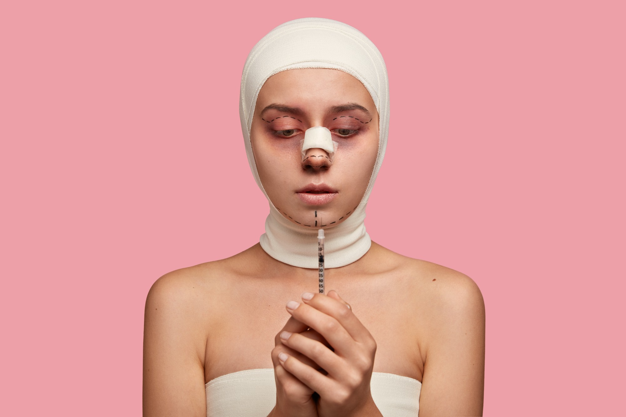 แก้จมูกแบบโอเพ่นคือ