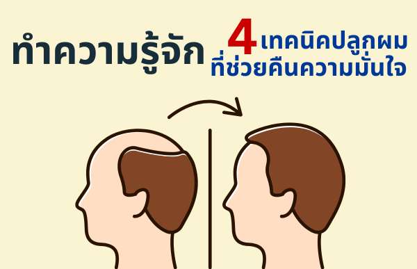 คืนความมั่นใจให้เส้นผม! ปลูกผมทางเลือกใหม่สำหรับคนอยากมั่นใจอีกครั้ง