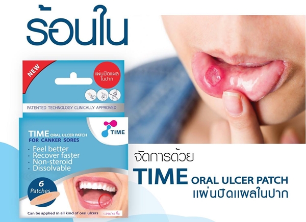 ร้อนใน แผ่นแปะ แก้ร้อนใน ยาทาแก้ร้อนใน