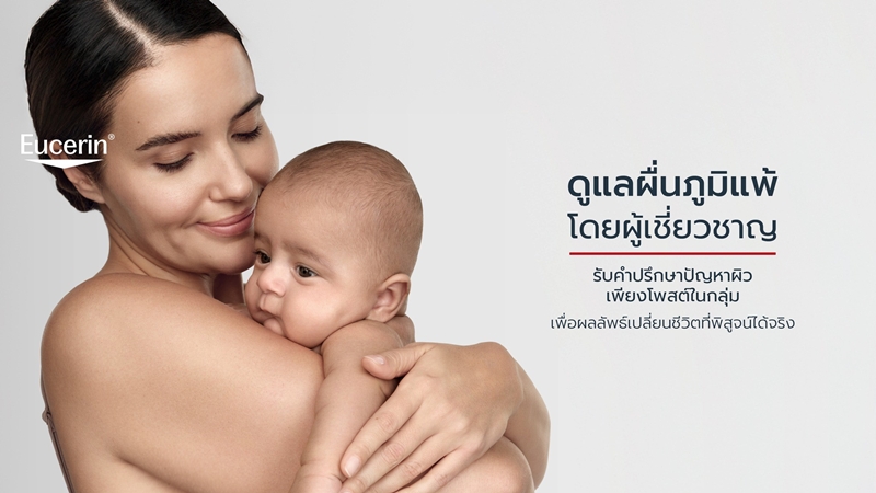 ยูเซอรินเดินหน้าภารกิจเพื่อสังคมต่อเนื่อง ยกระดับคุณภาพชีวิตของผู้ที่มีปัญหาผิวในประเทศไทย