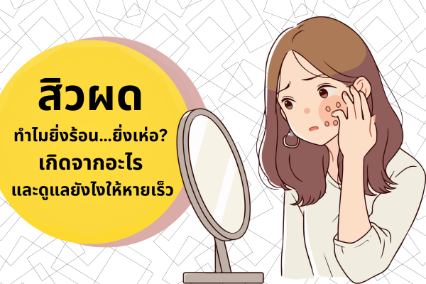 สิวผดในช่วงฤดูร้อน เกิดจากอะไร ทำไมยิ่งร้อนยิ่งเห่อ และควรดูแลผิวอย่างไรให้หายเร็ว 