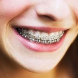 รู้จริง เรื่องจัดฟัน โดยทันตแพทย์ผู้เชี่ยวชาญ