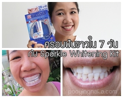 รีวิว Sparkle Whitening Kit D.I.Y. Dental กับการครอบฟันขาวใน 7 วัน