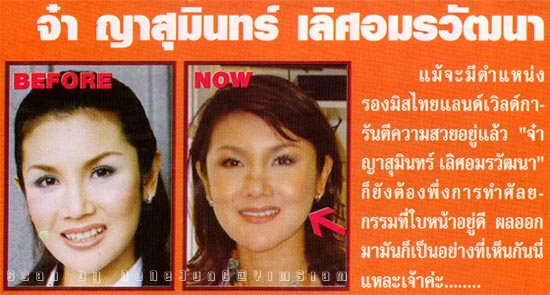 รูปภาพคอมเมนต์