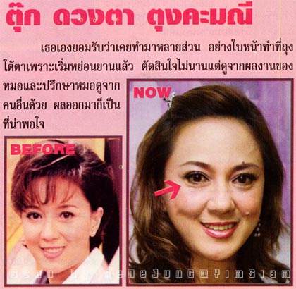 รูปภาพคอมเมนต์