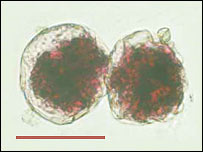 รูปภาพคอมเมนต์