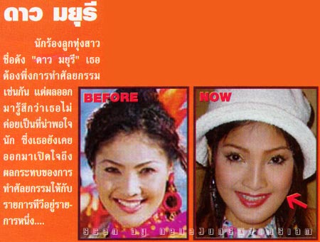 รูปภาพคอมเมนต์