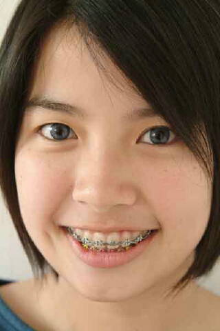 รูปภาพคอมเมนต์